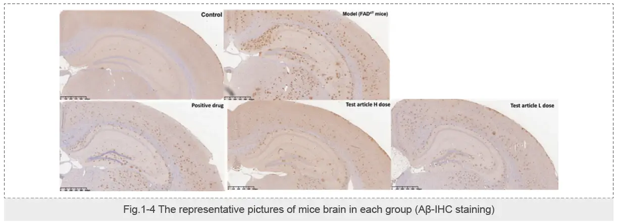 The β-amyloid in the hippocampus of FAD4T mice（IHC staining）-3.webp