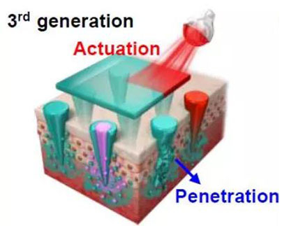 第三代：通过微针介导的皮肤层破坏和微针伴随的各种功能增强药物转运.jpg