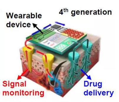 第四代透皮给药技术：在可穿戴设备的帮助下，用于患者定制治疗.jpg